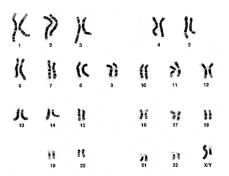 染色体の画像